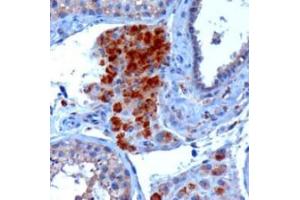 Image no. 1 for anti-SECIS Binding Protein 2 (SECISBP2) (Internal Region) antibody (ABIN374739) (SECISBP2 Antikörper  (Internal Region))