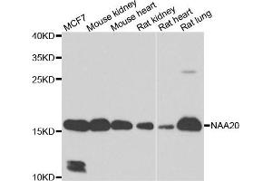 Western blot analysis of extracts of various cell lines, using NAA20 antibody. (NAT5 Antikörper)