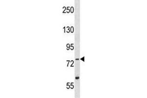 TLK2 antibody western blot analysis in Y79 lysate (TLK2 Antikörper  (AA 141-171))