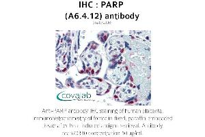 Image no. 1 for anti-Poly (ADP-Ribose) Polymerase 1 (PARP1) antibody (ABIN1723251) (PARP1 Antikörper)