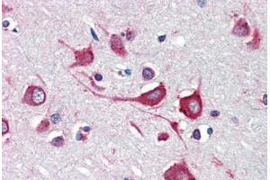 Human Brain, Cortex (formalin-fixed, paraffin-embedded) stained with Cholera Toxin antibody ABIN462099 at 10 ug/ml followed by biotinylated anti-mouse IgG secondary antibody ABIN481714, alkaline phosphatase-streptavidin and chromogen. (Calreticulin Antikörper)