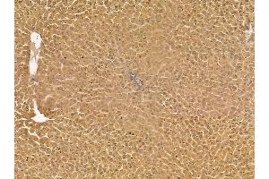 ALDH3A2 Mouse Monoclonal Antibody at 1/100 staining rat liver tissue by IHC-P. (ALDH3A2 Antikörper)