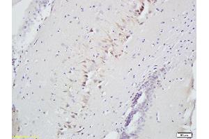 Formalin-fixed and paraffin embedded rat brain labeled with Anti-Slit2/Slil3 Polyclonal Antibody, Unconjugated (ABIN749963) at 1:300 followed by conjugation to the secondary antibody and DAB staining (SLIT2 Antikörper  (AA 451-550))