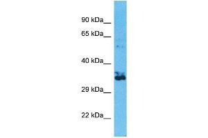 Western Blotting (WB) image for anti-Olfactory Receptor, Family 2, Subfamily W, Member 1-Like (OR2W3) (C-Term) antibody (ABIN2791730) (OR2W3 Antikörper  (C-Term))