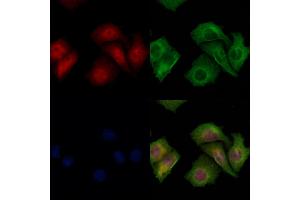 ABIN6266065 and ABIN6278212 staining Hela cells by IF/ICC.