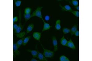 anti-KIT Ligand (KITLG) (AA 26-190) antibody