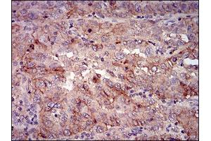 Immunohistochemistry (IHC) image for anti-BPI Fold Containing Family A, Member 2 (BPIFA2) (AA 16-169) antibody (ABIN1724943)