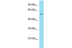 Host: Rabbit Target Name: ANKRD34C Sample Type: OVCAR-3 Whole Cell lysates Antibody Dilution: 1. (ANKRD34C Antikörper  (N-Term))