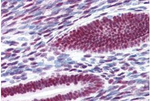 Human Uterus (formalin-fixed, paraffin-embedded) stained with ESR1 antibody ABIN337383 at 10 ug/ml followed by biotinylated goat anti-rabbit IgG secondary antibody ABIN481713, alkaline phosphatase-streptavidin and chromogen. (Estrogen Receptor alpha Antikörper  (C-Term))