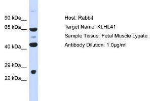 Host: Rabbit Target Name: KLHL41 Sample Type: Fetal Muscle lysates Antibody Dilution: 1. (Kelch-like protein 41 (KLHL41) (Middle Region) Antikörper)