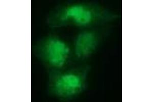 Anti-SPR mouse monoclonal antibody (ABIN2453681) immunofluorescent staining of COS7 cells transiently transfected by pCMV6-ENTRY SPR (RC205679). (SPR Antikörper)