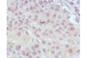 Immunohistochemistry (IHC) image for anti-Myeloid/lymphoid Or Mixed-Lineage Leukemia (MLL) (AA 3751-3968) antibody (ABIN2464083) (MLL/KMT2A Antikörper  (AA 3751-3968))