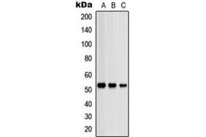 Western blot analysis of PRKAR2B expression in HeLa (A), SHSY5Y (B), NIH3T3 (C) whole cell lysates. (PRKAR2B Antikörper  (Center))