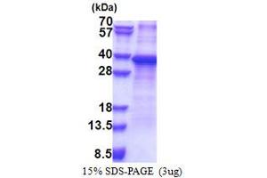 SDS-PAGE (SDS) image for Ribosomal Protein S2 (RPS2) (AA 1-293) protein (His tag) (ABIN5853321)