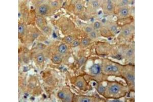 Used in DAB staining on fromalin fixed paraffin-embedded Liver tissue (PNLIP Antikörper  (AA 201-412))