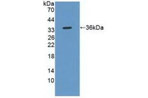 Western Blotting (WB) image for anti-C-Ros Oncogene 1 , Receptor tyrosine Kinase (ROS1) (AA 1945-2222) antibody (ABIN7442438)
