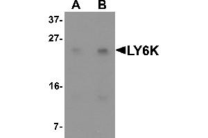 Western blot analysis of LY6K in HeLa cell lysate with LY6K antibody at (A) 1 and (B) 2 µg/mL. (Ly6k Antikörper  (N-Term))