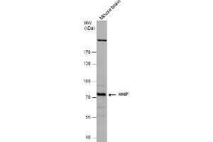 WB Image HHIP antibody [N3C2], Internal detects HHIP protein by western blot analysis. (HHIP Antikörper)