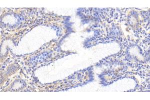 Immunohistochemistry (IHC) image for anti-Heat Shock 60kDa Protein 1 (Chaperonin) (HSPD1) (AA 1-573) antibody (ABIN7432685)
