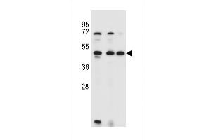 ANKRD40 Antibody (C-term) (ABIN655309 and ABIN2844891) western blot analysis in 293,HL-60,MCF-7 cell line lysates (35 μg/lane). (ANKRD40 Antikörper  (C-Term))