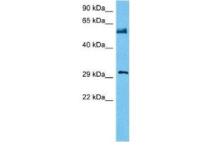 Host:  Mouse  Target Name:  NFIA  Sample Tissue:  Mouse Testis  Antibody Dilution:  1ug/ml (NFIA Antikörper  (Middle Region))