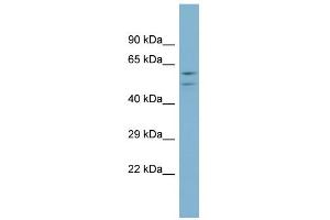 Western Blotting (WB) image for anti-ATPase, H+ Transporting, Lysosomal 56/58kDa, V1 Subunit B1 (ATP6V1B1) (Middle Region) antibody (ABIN2786641)
