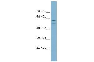 WB Suggested Anti-ATP6V1B1 Antibody Titration: 0. (ATP6V1B1 Antikörper  (Middle Region))