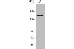 Western Blot analysis of 293 cells using Cleaved-COL4A3 (L1425) Polyclonal Antibody (COL4a3 Antikörper  (Cleaved-Leu1425))