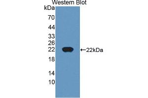 Figure. (CTAG1B Antikörper  (AA 1-180))