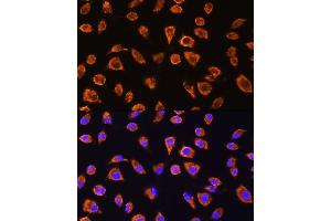 Immunofluorescence analysis of L929 cells using NOTCH4 Rabbit pAb (ABIN6132420, ABIN6144740, ABIN6144741 and ABIN6224315) at dilution of 1:100. (NOTCH4 Antikörper  (AA 1824-2003))