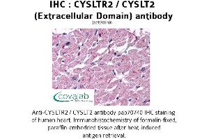 Image no. 1 for anti-Cysteinyl Leukotriene Receptor 2 (CYSLTR2) (1st Extracellular Domain) antibody (ABIN1733462) (CasLTR2 Antikörper  (1st Extracellular Domain))
