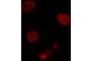 ABIN6274502 staining Hela cells by IF/ICC. (PBOV1 Antikörper  (Internal Region))