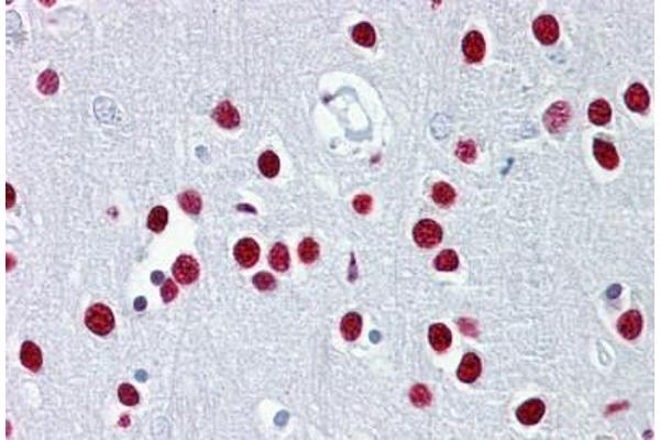 TUB anticorps  (AA 144-193)