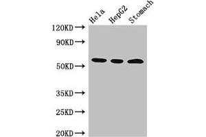 Western Blot Positive WB detected in: Hela whole cell lysate, HepG2 whole cell lysate, Mouse stomach tissue All lanes: MDM4 antibody at 3 μg/mL Secondary Goat polyclonal to rabbit IgG at 1/50000 dilution Predicted band size: 55, 15, 14, 19, 50 kDa Observed band size: 55 kDa (MDM4-binding Protein Antikörper  (AA 208-306))