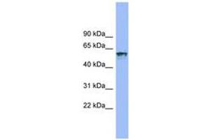 Image no. 1 for anti-Interleukin 18 Receptor 1 (IL18R1) (AA 35-84) antibody (ABIN6743248) (IL18R1 Antikörper  (AA 35-84))