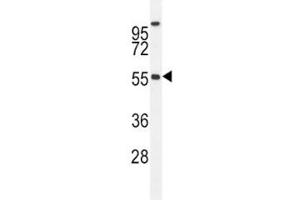 BMP4 antibody western blot analysis in MDA-MB435 lysate. (BMP4 Antikörper  (AA 5-34))