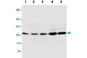 Western blot analysis of tissue and whole cell extracts with CDC42 polyclonal antibody .
