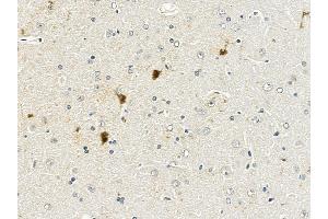 APP Mouse Monoclonal Antibody at 1/100 staining rat brain tissue by IHC-P.