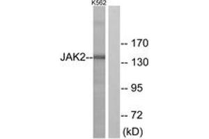 Western blot analysis of extracts from K562 cells, using JAK2 (Ab-221) Antibody.
