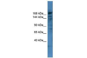 WB Suggested Anti-COL4A6 Antibody Titration: 0.