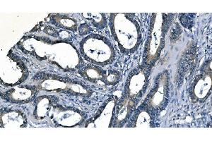 IHC analysis of ASS1 using anti-ASS1 antibody (ABIN7601192). (ASS1 Antikörper  (AA 3-365))