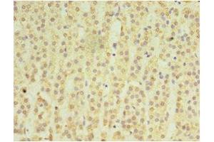 Immunohistochemistry of paraffin-embedded human adrenal gland tissue using ABIN7159049 at dilution of 1:100 (Matrilin 3 Antikörper  (AA 277-486))