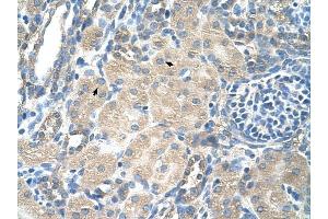 SLC13A3 antibody was used for immunohistochemistry at a concentration of 4-8 ug/ml to stain Epithelial cells of renal tubule (arrows) in Human Kidney. (SLC13A3 Antikörper)