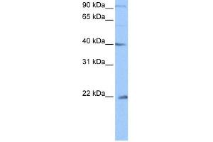 WB Suggested Anti-C4orf33 Antibody Titration: 0. (C4orf33 Antikörper  (C-Term))