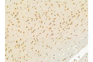 NF-kB p65 Mouse Monoclonal Antibody at 1/100 staining mouse brain tissue by IHC-P.