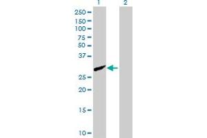 Western Blot analysis of CFHR2 expression in transfected 293T cell line by CFHR2 MaxPab polyclonal antibody. (CFHR2 Antikörper  (AA 19-270))