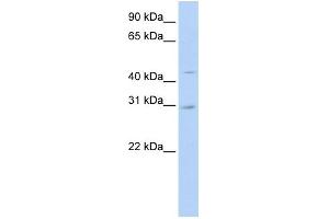 WB Suggested Anti-SLC10A4 Antibody Titration:  0. (SLC10A4 Antikörper  (N-Term))