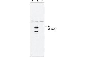 Western Blotting (WB) image for anti-Ras-Like Without CAAX 1 (RIT1) antibody (ABIN264412) (RIT1 Antikörper)