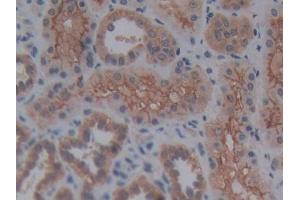 DAB staining on IHC-P; Samples: Human Kidney Tissue (Reelin Antikörper  (AA 2086-2296))