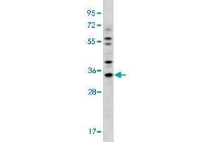 Western blot analysis of MDA-MB-231 cell lysate (35 ug/lane) with GJB5 polyclonal antibody . (GJB5 Antikörper  (Internal Region))